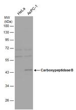 Carboxypeptidase B1 Antibody in Western Blot (WB)