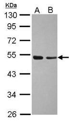 TAF7 Antibody in Western Blot (WB)