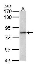 MTMR14 Antibody in Western Blot (WB)