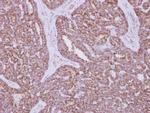 HK1 Antibody in Immunohistochemistry (Paraffin) (IHC (P))