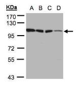 HK1 Antibody in Western Blot (WB)