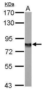 NDUFS1 Antibody in Western Blot (WB)