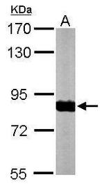 NDUFS1 Antibody in Western Blot (WB)