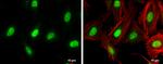 ZEB1 Antibody in Immunocytochemistry (ICC/IF)