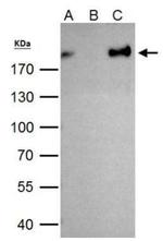 ZEB1 Antibody in Immunoprecipitation (IP)