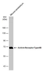 ACVR2B Antibody in Western Blot (WB)