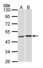 PSMC5 Antibody in Western Blot (WB)