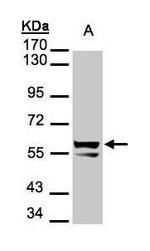 Cytokeratin 6 Antibody in Western Blot (WB)