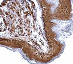 XPD Antibody in Immunohistochemistry (Paraffin) (IHC (P))