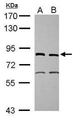 XPD Antibody in Western Blot (WB)