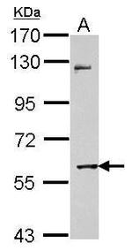 MMP8 Antibody in Western Blot (WB)