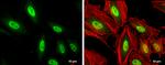 MEF2C Antibody in Immunocytochemistry (ICC/IF)