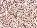 MEF2C Antibody in Immunohistochemistry (Paraffin) (IHC (P))