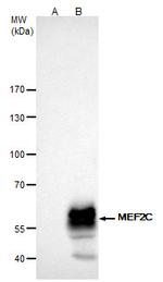 MEF2C Antibody in Immunoprecipitation (IP)