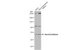 STS Antibody in Western Blot (WB)