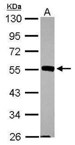 JNK2 Antibody in Western Blot (WB)