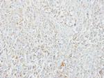 MIPEP Antibody in Immunohistochemistry (Paraffin) (IHC (P))