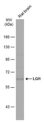 LGI1 Antibody in Western Blot (WB)