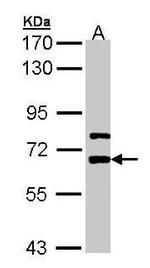 LGI1 Antibody in Western Blot (WB)