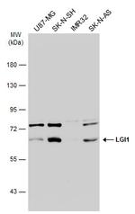 LGI1 Antibody in Western Blot (WB)