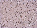 NFIB Antibody in Immunohistochemistry (Paraffin) (IHC (P))