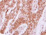 PTPN14 Antibody in Immunohistochemistry (Paraffin) (IHC (P))