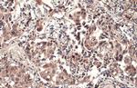 PTPN14 Antibody in Immunohistochemistry (Paraffin) (IHC (P))