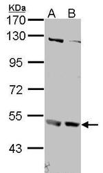 IFNAR2 Antibody in Western Blot (WB)