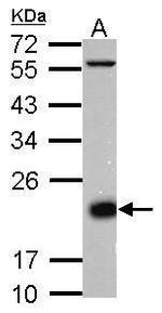 CD3d Antibody in Western Blot (WB)