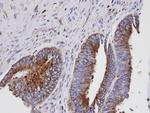 GIT1 Antibody in Immunohistochemistry (Paraffin) (IHC (P))