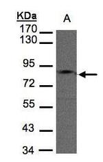 GIT1 Antibody in Western Blot (WB)