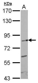 GIT1 Antibody in Western Blot (WB)