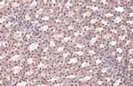 RAD21 Antibody in Immunohistochemistry (Paraffin) (IHC (P))