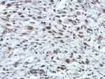 RAD21 Antibody in Immunohistochemistry (Paraffin) (IHC (P))