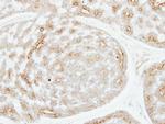 ADPGK Antibody in Immunohistochemistry (Paraffin) (IHC (P))