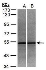 ADPGK Antibody in Western Blot (WB)