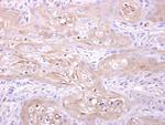 Adenylate Kinase 1 Antibody in Immunohistochemistry (Paraffin) (IHC (P))