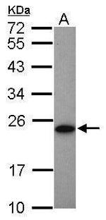 Adenylate Kinase 1 Antibody in Western Blot (WB)