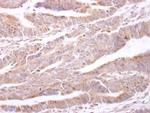 PTP1B Antibody in Immunohistochemistry (Paraffin) (IHC (P))