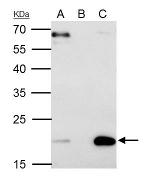 Sorcin Antibody in Immunoprecipitation (IP)