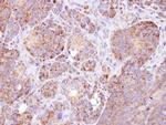 GSTZ1 Antibody in Immunohistochemistry (Paraffin) (IHC (P))