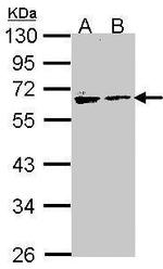 Arylsulfatase A Antibody in Western Blot (WB)