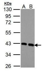 Calponin 3 Antibody in Western Blot (WB)