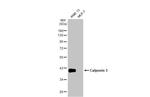 Calponin 3 Antibody in Western Blot (WB)