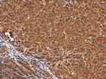 Calponin 3 Antibody in Immunohistochemistry (Paraffin) (IHC (P))