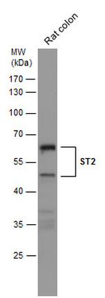 ST2 Antibody in Western Blot (WB)