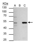 ESRRA Antibody in Immunoprecipitation (IP)