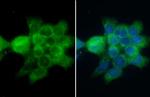 CD2AP Antibody in Immunocytochemistry (ICC/IF)