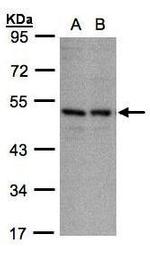 KIR3DL1 Antibody in Western Blot (WB)