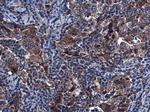 SIRT3 Antibody in Immunohistochemistry (Paraffin) (IHC (P))